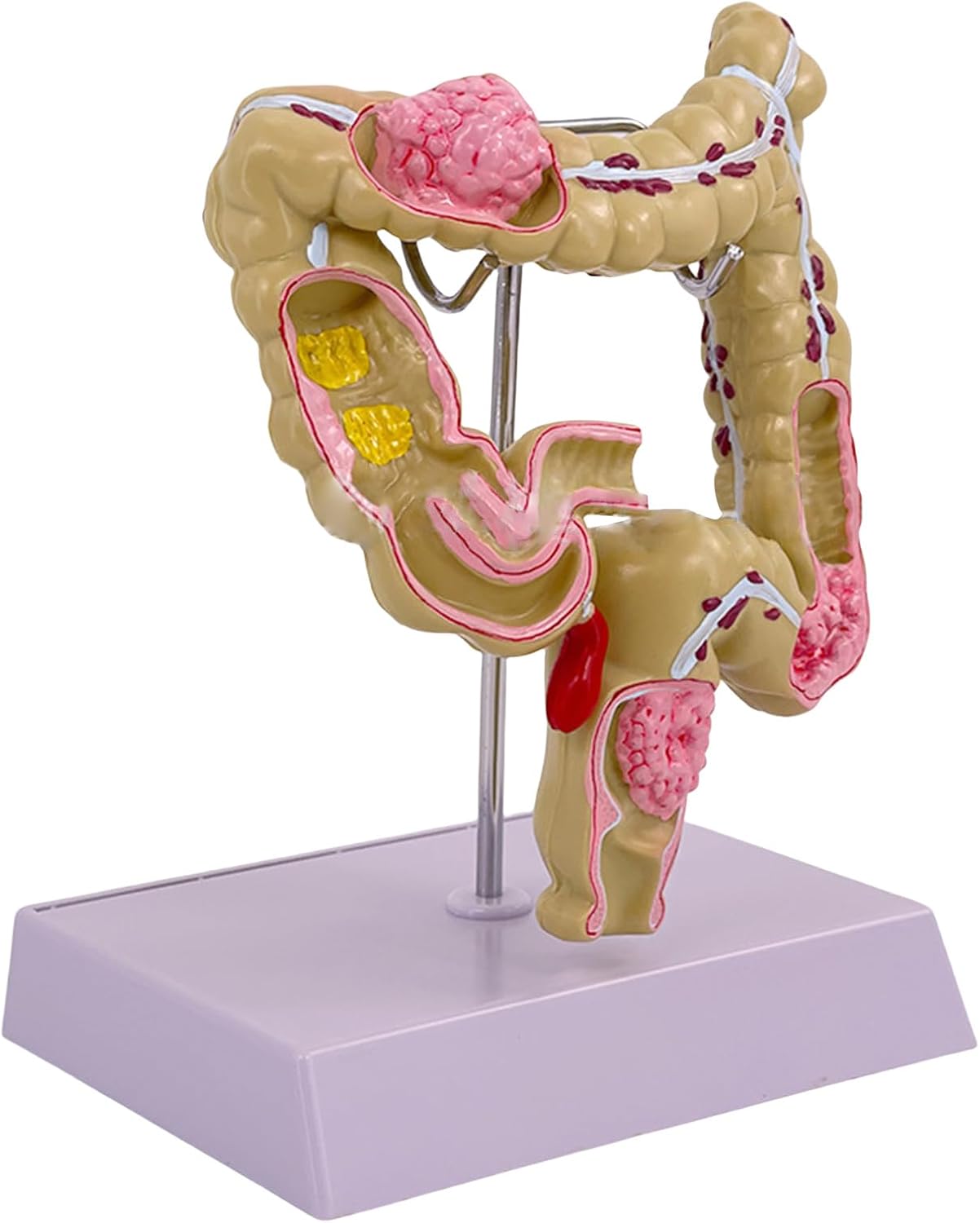 Modèle Anatomique Humain Modèle Gros Intestin Humain Pathologies Humaines Du Modèle Gros Intestin Pour L'enseignement Scientifique